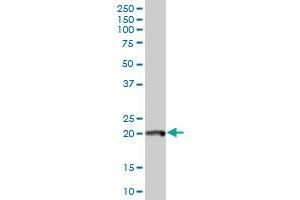 POLE3 antibody  (AA 1-147)