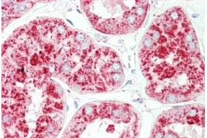 Human Kidney: Formalin-Fixed, Paraffin-Embedded (FFPE) (LAMP1 antibody)