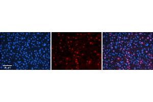 Immunohistochemistry (IHC) image for anti-Mediator Complex Subunit 7 (MED7) (N-Term) antibody (ABIN2778098)