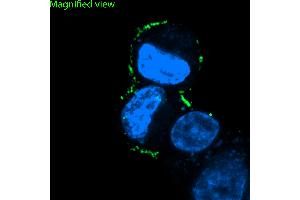 CRF1 was detected in live PC12 pheochromocytoma cells by confocal microscopy using Anti-CRF1/CRHR1 (extracellular) Antibody (ABIN7043086, 1:25), followed by goat anti-rabbit secondary antibody conjugated to Alexa Fluor® 488 (green).