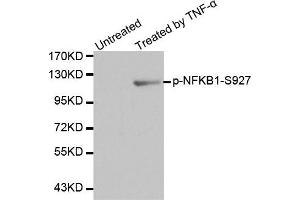 Western Blotting (WB) image for anti-Nuclear Factor of kappa Light Polypeptide Gene Enhancer in B-Cells 1 (NFKB1) (pSer927) antibody (ABIN1870466) (NFKB1 antibody  (pSer927))