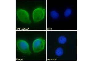 ABIN185577 Immunofluorescence analysis of paraformaldehyde fixed MCF7 cells, permeabilized with 0. (ADRA2A antibody  (Internal Region))