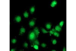 Anti-C1S mouse monoclonal antibody (ABIN2455521) immunofluorescent staining of COS7 cells transiently transfected by pCMV6-ENTRY C1S (RC218963). (C1S antibody)