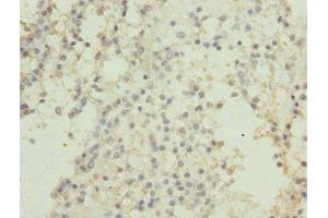 Immunohistochemistry (IHC) image for anti-Casein Kinase 1, gamma 2 (CSNK1G2) (AA 316-415), (Isoform gamma 2) antibody (ABIN7146876)