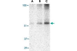 Western blot analysis of TANK in Daudi cell lysate with TANK polyclonal antibody  at (A) 0.