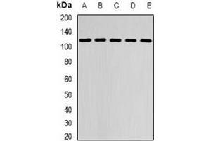 Western blot analysis of DHTKD1 expression in MCF7 (A), HepG2 (B), mouse brain (C), mouse kidney (D), rat liver (E) whole cell lysates.
