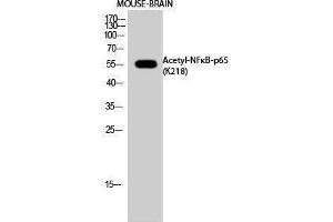 Western Blotting (WB) image for anti-Nuclear Factor-kB p65 (NFkBP65) (acLys218) antibody (ABIN3181891) (NF-kB p65 antibody  (acLys218))