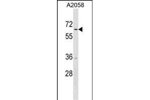 TRIM35 Antibody (C-term) (ABIN1537330 and ABIN2850370) western blot analysis in  cell line lysates (35 μg/lane). (TRIM35 antibody  (C-Term))