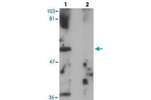 Western blot analysis of PPHLN1 in mouse colon tissue with PPHLN1 polyclonal antibody  at 1 ug/mL in (lane 1) the absence and (lane 2) the presence of blocking peptide. (PPHLN1 antibody  (Internal Region))
