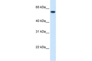 Western Blotting (WB) image for anti-Formiminotransferase Cyclodeaminase (FTCD) antibody (ABIN2462433) (FTCD antibody)