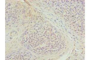 Immunohistochemistry of paraffin-embedded human tonsil tissue using ABIN7173675 at dilution of 1:100 (TUBB1 antibody  (AA 270-451))