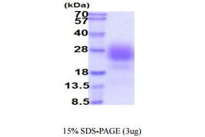 SDS-PAGE (SDS) image for Syndecan 2 (SDC2) (AA 19-144) protein (His tag) (ABIN6388065) (Syndecan 2 Protein (SDC2) (AA 19-144) (His tag))