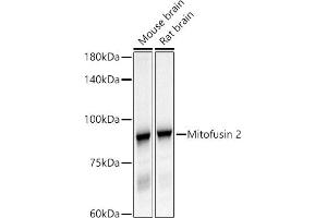 Western blot analysis of extracts of various cell lines, using Mitofusin 2 antibody (ABIN6133825, ABIN6143800, ABIN6143803 and ABIN6216518) at 1:500 dilution. (MFN2 antibody  (AA 500-600))