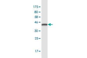 Western Blot detection against Immunogen (36. (Desmoglein 4 antibody  (AA 531-630))