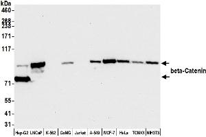 Western Blotting (WB) image for anti-Catenin, beta (CATNB) (AA 725-775) antibody (ABIN7455205)