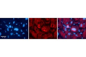 Immunohistochemistry (IHC) image for anti-Nuclear Factor of Activated T-Cells, Cytoplasmic, Calcineurin-Dependent 1 (NFATC1) (N-Term) antibody (ABIN2780747)