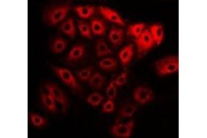 Immunofluorescent analysis of NEK2 staining in U2OS cells. (NEK2 antibody)