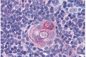 Human Thymus: Formalin-Fixed, Paraffin-Embedded (FFPE) (PYCARD antibody  (AA 31-46))