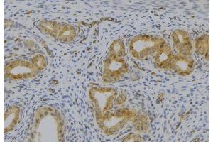 ABIN6277515 at 1/100 staining Human uterus tissue by IHC-P. (KLKB1 antibody  (Internal Region))
