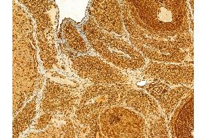 ABIN6262905, ABIN6268707, ABIN6268708 and ABIN6268709 at 1/100 staining Rat ovary tissue by IHC-P. (Lamin B1 antibody)