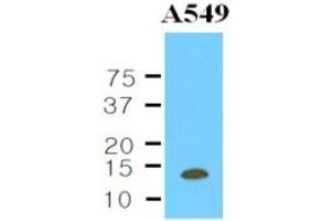 Western Blotting (WB) image for anti-Cystatin B (Stefin B) (CSTB) (AA 1-98), (N-Term) antibody (ABIN263931) (CSTB antibody  (N-Term))