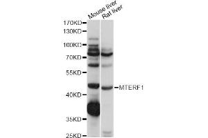 Western blot analysis of extracts of various cell lines, using MTERF1 antibody (ABIN6291170) at 1:1000 dilution.