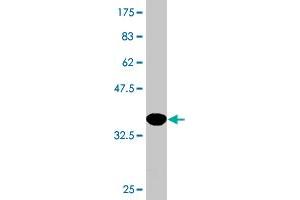 Western Blot detection against Immunogen (37. (PIK3C2B antibody  (AA 1-110))