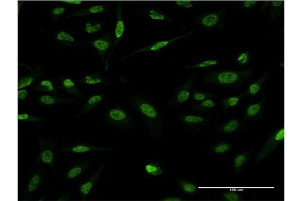 LMO4 antibody  (AA 1-165)