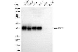 Western blotting analysis using M6PR antibody (ABIN7799331).