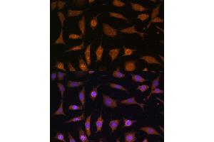 Immunofluorescence analysis of L929 cells using PDE6D Polyclonal Antibody (ABIN7269303) at dilution of 1:100 (40x lens). (PDE6D antibody  (AA 1-150))