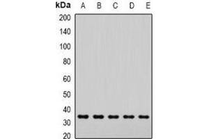 Western blot analysis of SNAP-alpha expression in Hela (A), Jurkat (B), mouse brain (C), mouse lung (D), rat liver (E) whole cell lysates.