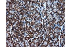 Immunohistochemical staining of paraffin-embedded colon tissue using anti-TPMT mouse monoclonal antibody.