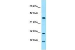Image no. 1 for anti-Small Nuclear Ribonucleoprotein Polypeptide E (SNRPE) (AA 30-79) antibody (ABIN6748183) (SNRPE antibody  (AA 30-79))