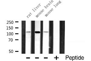 Western blot analysis of RBM26 expression in various lysates (RBM26 antibody  (Internal Region))