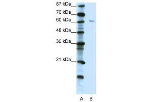 ZNF286 antibody (20R-1219) used at 5 ug/ml to detect target protein. (ZNF286A antibody  (C-Term))