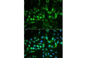 Immunofluorescence analysis of MCF7 cell using TIMP2 antibody. (TIMP2 antibody  (AA 100-200))