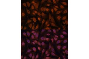 Immunofluorescence analysis of U-2 OS cells using ZNF131 antibody (ABIN7271453) at dilution of 1:100. (ZNF131 antibody  (AA 80-240))