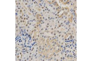 Immunohistochemistry of paraffin-embedded mouse kidney using RBFOX3 antibody at dilution of 1:200 (x400 lens). (NeuN antibody)