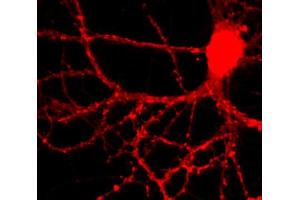 Immunofluorescence labeling of a hippocampus neuron (dilution 1 : 1000).