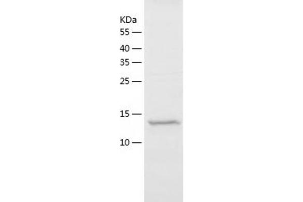 beta Synuclein Protein (AA 1-134) (His tag)