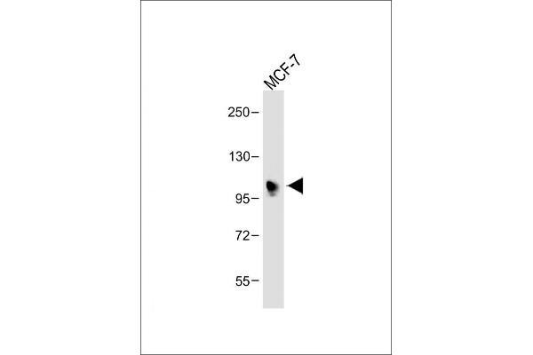 INPP4B 抗体  (AA 367-393)