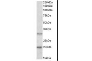 Image no. 1 for anti-Asparaginase Like 1 (ASRGL1) (Internal Region) antibody (ABIN374933) (ASRGL1 antibody  (Internal Region))