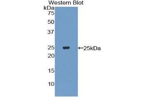 Detection of Recombinant IL27, Mouse using Polyclonal Antibody to Interleukin 27A (IL27A) (IL27 antibody  (AA 29-234))
