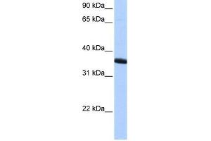 Western Blot showing ZNF389 antibody used at a concentration of 1-2 ug/ml to detect its target protein. (ZNF192P1 antibody  (N-Term))