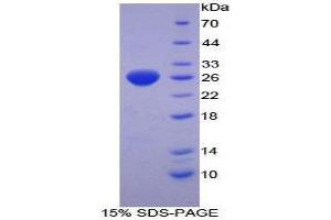 SDS-PAGE (SDS) image for Thioredoxin Reductase 1 (TXNRD1) (AA 374-577) protein (His tag) (ABIN2126945)