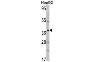 Image no. 1 for anti-Aminomethyltransferase (AMT) (N-Term) antibody (ABIN452734) (Aminomethyltransferase antibody  (N-Term))