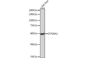 Western blot analysis of extracts of Rat liver, using CYP26 Rabbit mAb (ABIN7266654) at 1:1000 dilution. (CYP26A1 antibody)