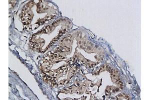 Immunohistochemistry (IHC) image for anti-Minichromosome Maintenance Complex Component 2 (MCM2) (AA 601-700) antibody (ABIN676238)