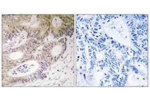 Immunohistochemistry (IHC) image for anti-Ribosomal Protein S6 Kinase, 90kDa, Polypeptide 5 (RPS6KA5) (Ser212) antibody (ABIN1848238) (MSK1 antibody  (Ser212))