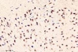 Immunohistochemistry (Paraffin-embedded Sections) (IHC (p)) image for anti-DAZ Associated Protein 1 (DAZAP1) antibody (ABIN7073691)
